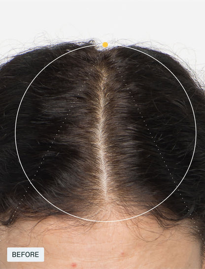 Nutrafol Women Hair Growth Supplements, Ages18-44,1-Month Bottle